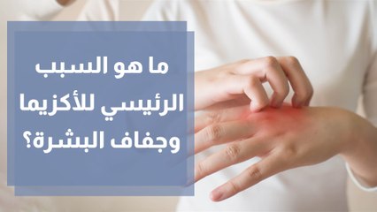 طرق علاج الأكزيما والبشرة الجافة