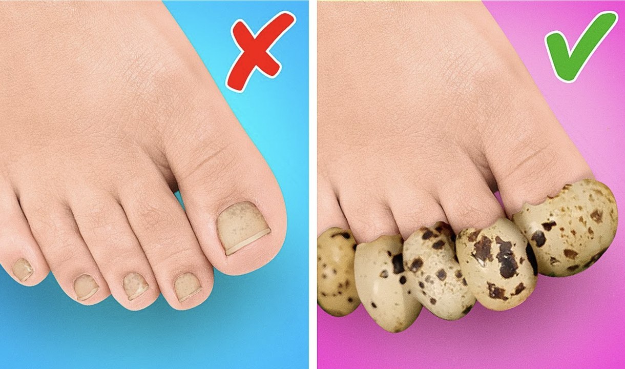 ASTUCES & GADGETS BRILLANTS POUR LES PIEDS || INCROYABLES CRÉATIONS DE CHAUSSURES