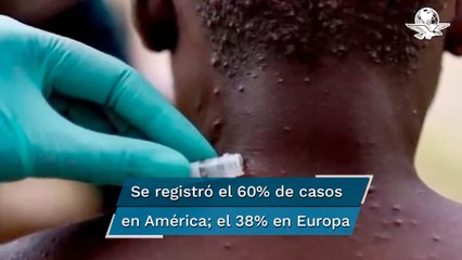 Casos de viruela del mono descienden en el mundo, pero aumentan en América