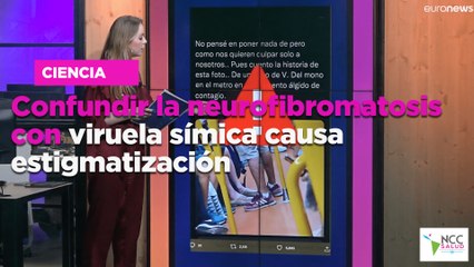 Confundir la neurofibromatosis con viruela símica causa estigmatización