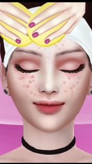 asmr doctor face surgery ,pimples remove on face ,pinples surgery animation through video
