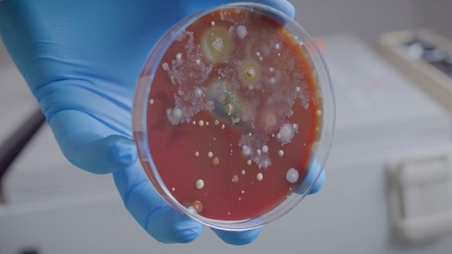 Les sèche-mains, de véritables nids à bactéries ?