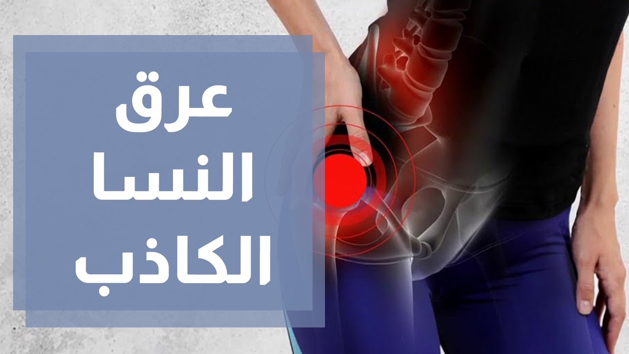 ما هو عرق النسا الكاذب؟ وما الأسباب وطرق العلاج؟