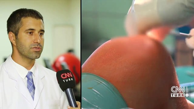 Menisküs sorununa kesin tedavi umudu