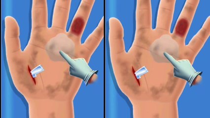 asmr animation hand surgery