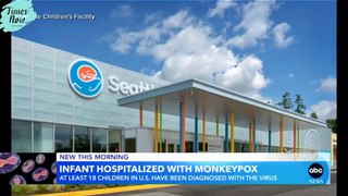 Infant hospitalized with monkeypox in Washington state