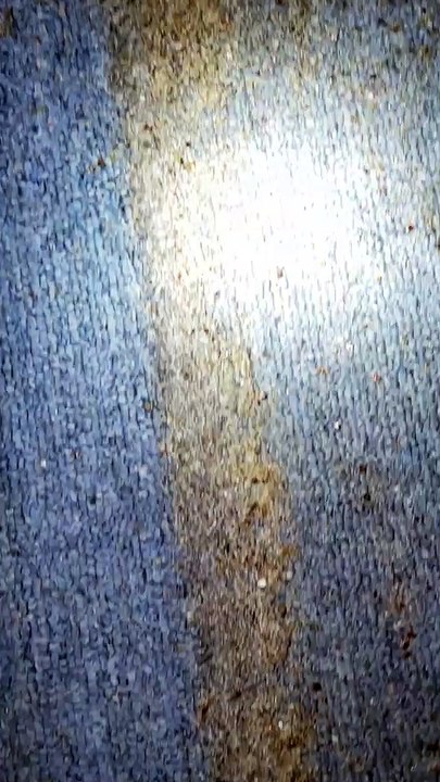 Really Bad Bedbug Infestation