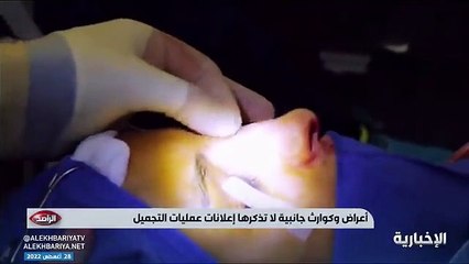 Descargar video: فيديو بعد هوس المشاهير بالعمليات - استشاري جراحة التجميل والترميم د. معاذ حكمي عمليات التجميل قد تشوه.. وأضرار بعضها أكثر من منافعها - - الراصد