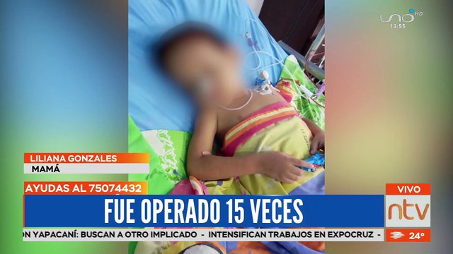Niño con hidrocefalia y 15 veces operado, suplica ayuda