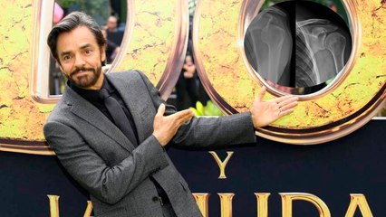 Eugenio Derbez tendrá un largo proceso de recuperación tras accidente