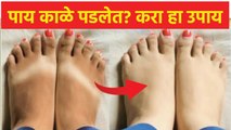 पायांवरचं tanning घालवण्यासाठी सोपा उपाय | how to remove tan from feet | Sun Tan Removal