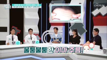 여자의 나이테 ❛주름❜이 나타내는 내 몸속 위험신호 TV CHOSUN 20220831 방송