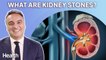 Urologist Answers YOUR Questions About Kidney Stones | Ask An Expert