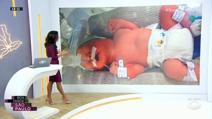 Mãe descobre gravidez de gêmeos na hora do parto 31/08/2022 15:17:13