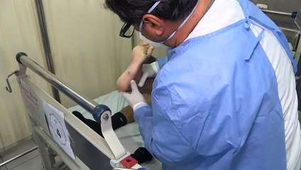 Más de 50.000 casos de viruela del mono en todo el mundo