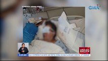 71-anyos na Pinay sa Amerika, nakaranas ng pagdurugo sa utak matapos hampasin at nakawan | UB