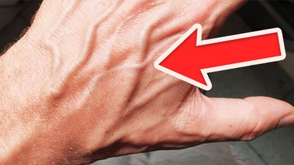 हाथ की नसें क्यों फूलती हैं । Hath Ki Nas Kyu Phulti hai । Boldsky *Health