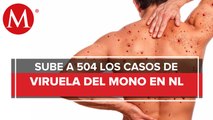 Se incrementan casos de viruela símica, llega Nuevo León a 9: informa Salud