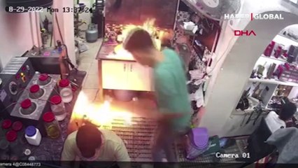 Lavaboya dökülen aseton parladı, çalışanın elindeki aseton şişesi tutuştu