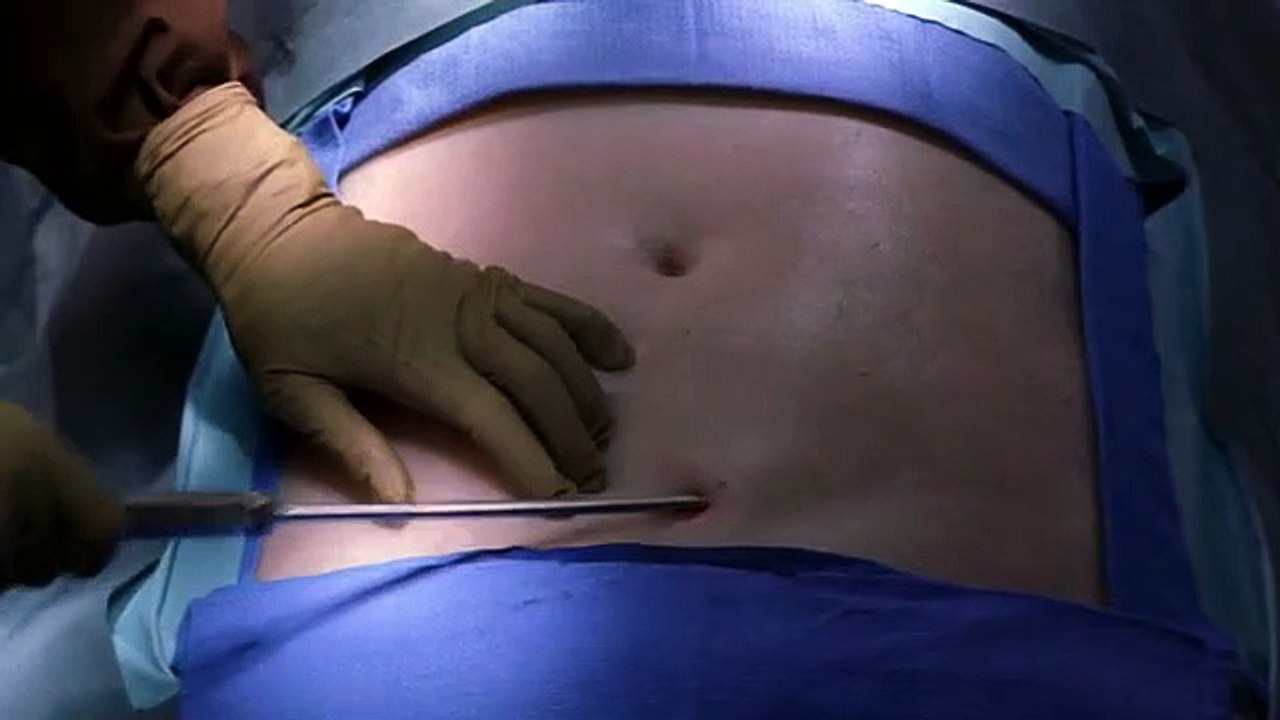 Nip-Tuck - Schönheit hat ihren Preis Staffel 3 Folge 13 HD Deutsch