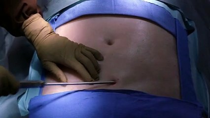 Nip-Tuck - Schönheit hat ihren Preis Staffel 3 Folge 13 HD Deutsch