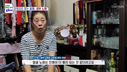 환절기 피부 주의보 노화가 빠르게 찾아온 주인공 TV CHOSUN 20220904 방송