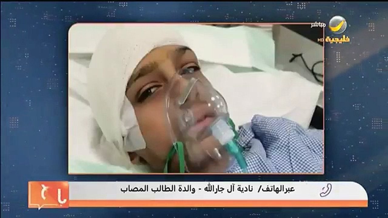 طالب يكسر جمجمة زميله.. - والدة الطالب المُصاب...
