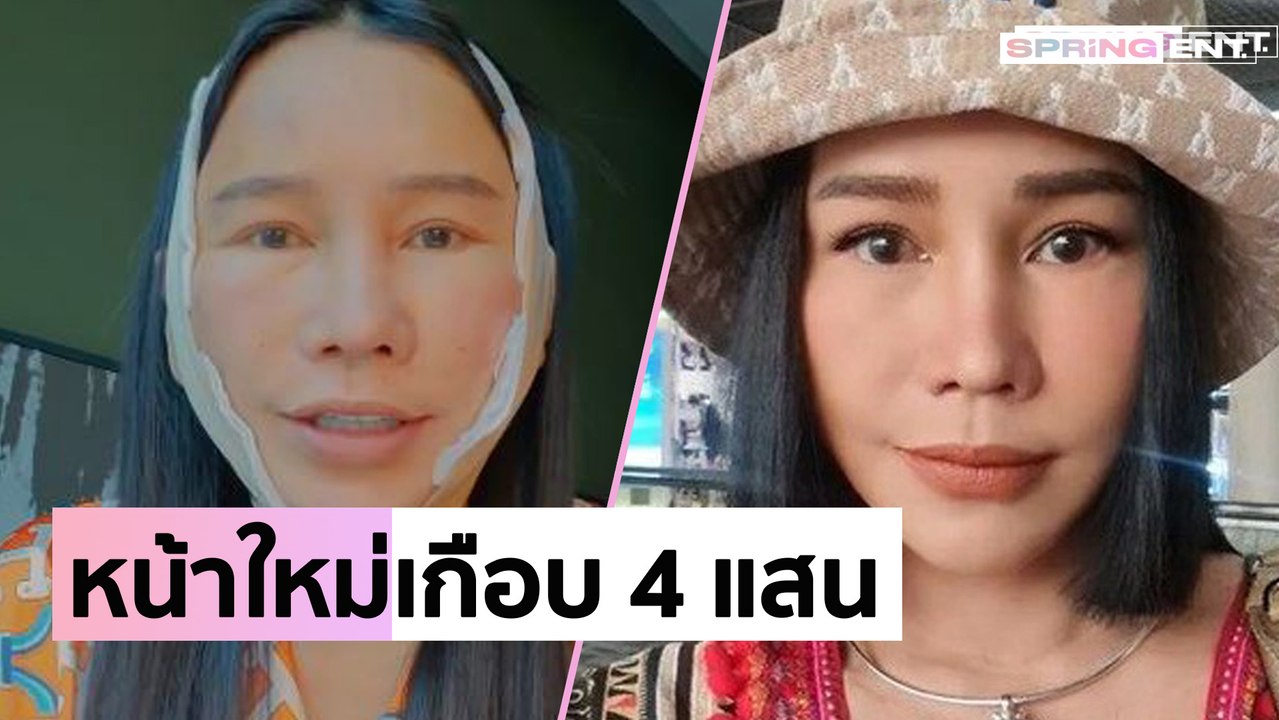 "ส้มเช้ง สามช่า" โชว์หน้าใหม่! หลังทุ่มเงินทำศัลยกรรมที่เกาหลีเกือบ 4 แสนบาท