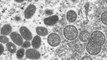 New monkeypox drug from UC San Diego