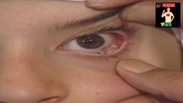 Diamond tears girl name - World's most dangerous trees - @Facts Mall - Top 5 facts - Amazing facts