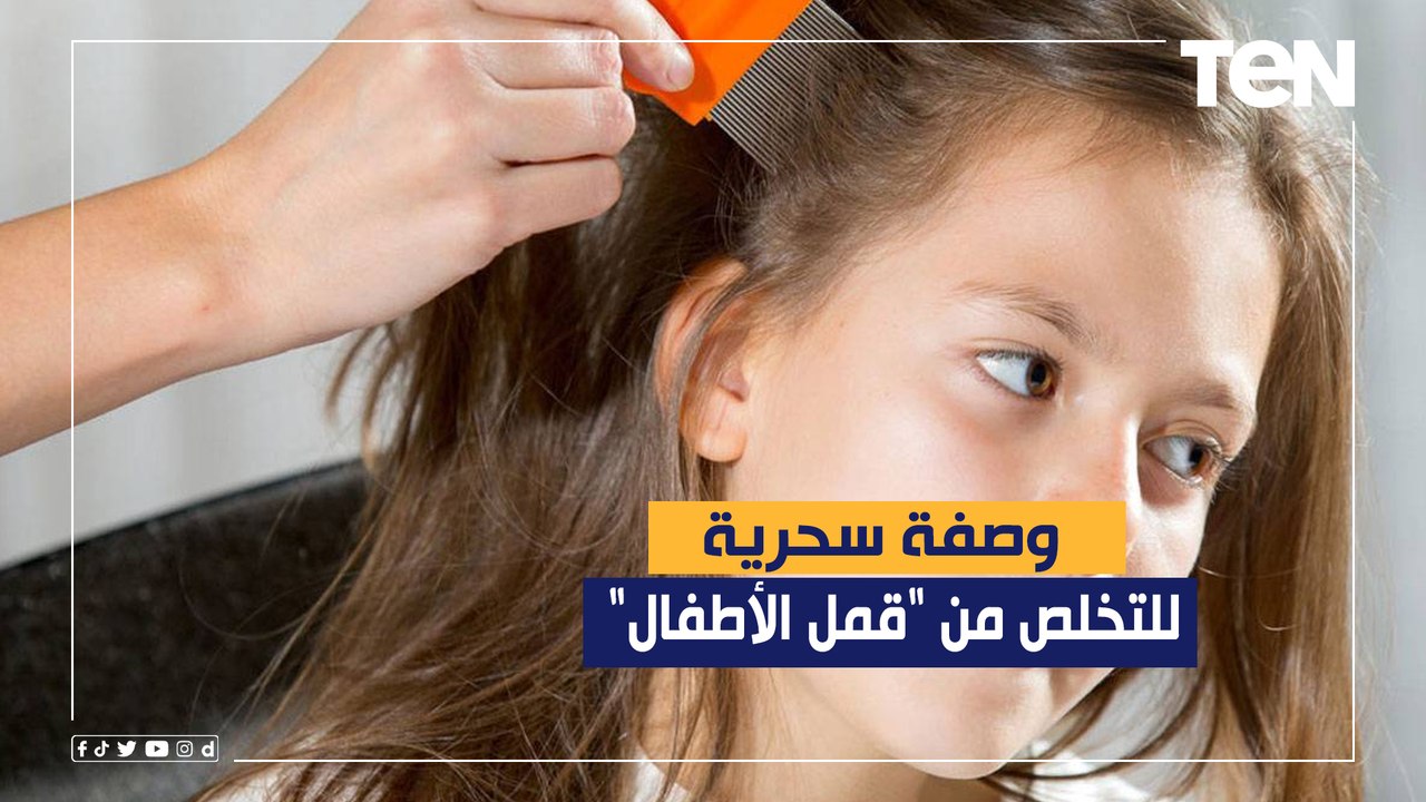 الدكتور هاني الناظر يقدم وصفة سحرية للتخلص من "قمل الأطفال"