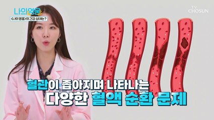 사망원인 1위 돌연사를 유발하는 혈액 순환 장애 TV CHOSUN 220906 방송