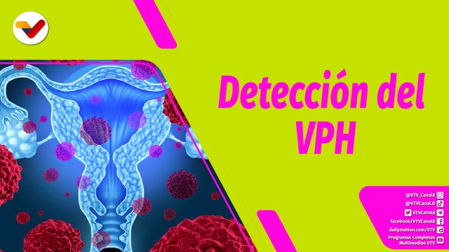 Buena Vibra | Estudio del virus VPH y su incidencia en el cáncer de cuello uterino