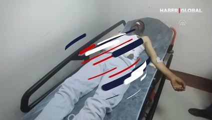 Bingöl'de ayı saldırısına uğrayan çoban ölümden öndü