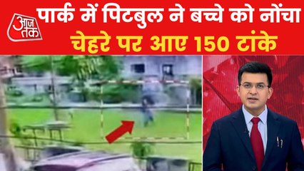 Pitbull bites off chunk of 10-year-old Ghaziabad boy face