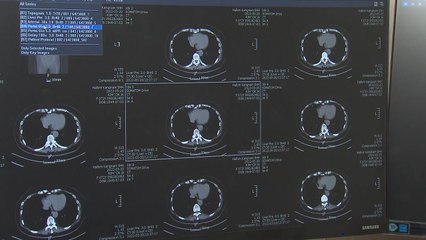 '고기 먹고 운동 부족' 젊은 층 대장암 비상...예방법은? / YTN