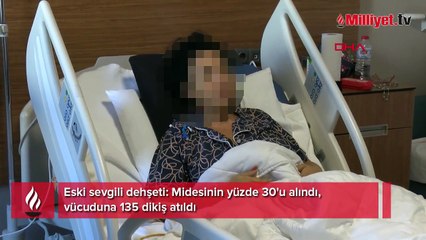 Eski sevgili dehşeti! Midesinin yüzde 30'u alındı, vücuduna 135 dikiş atıldı