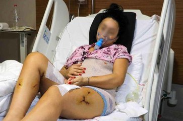 Son dakika haber! Eski erkek arkadaşının bıçakladığı Burcu yaşam mücadelesini kazandı