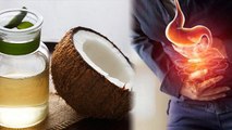 कब्ज़ में नारियल तेल दिलाएगा राहत | Coconut oil से कब्ज़ ऐसे होगा दूर | Boldsky *health