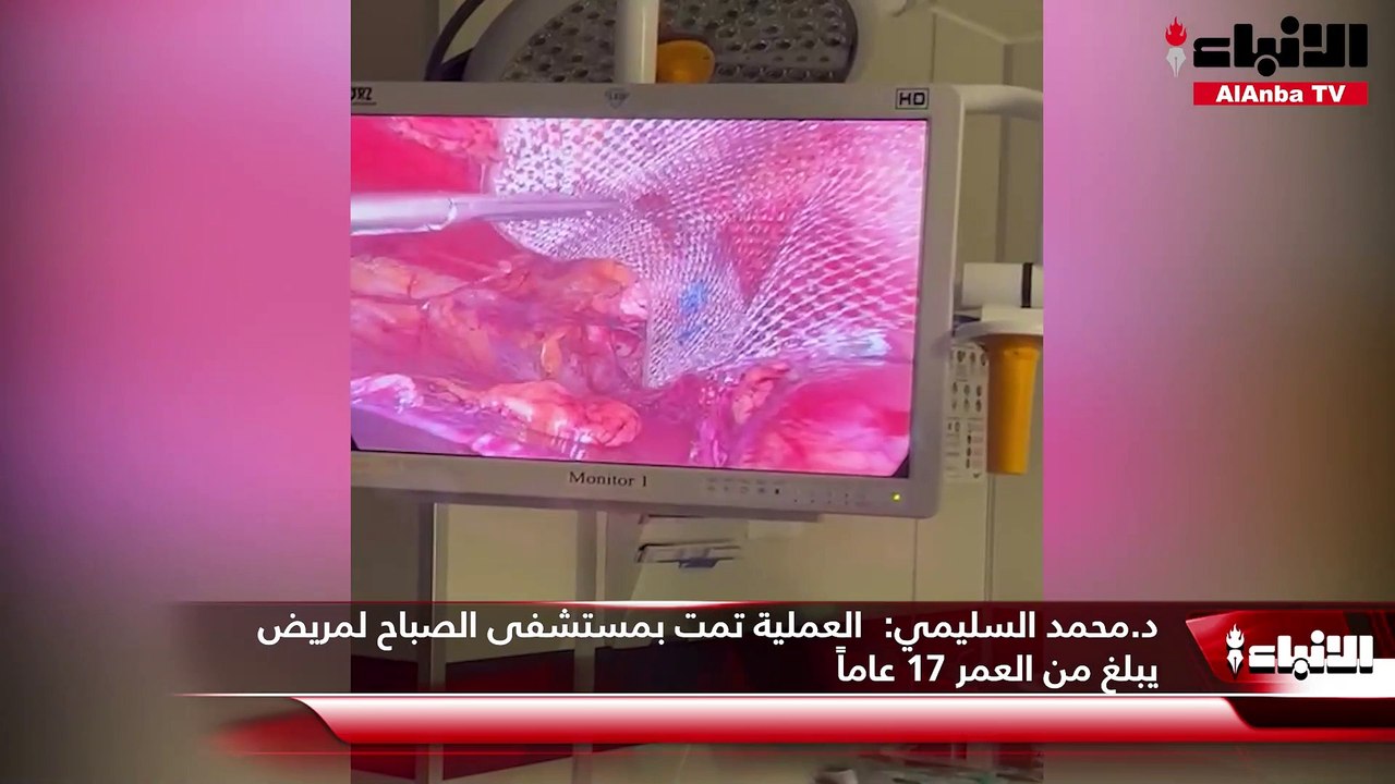 د.محمد السليمي: نجاح عملية «فتق أربي» كبير وغير مباشر باستخدام المنظار