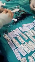 Ameliyat sırasında şok eden görüntüler! Doktorlar sağlam dikiş ipi bulamadı..