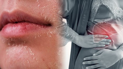 Dry Skin होना इन गंभीर बीमारियों का खतरा,Skin Infection से लेकर Kidney Problem तक खतरा । *Health