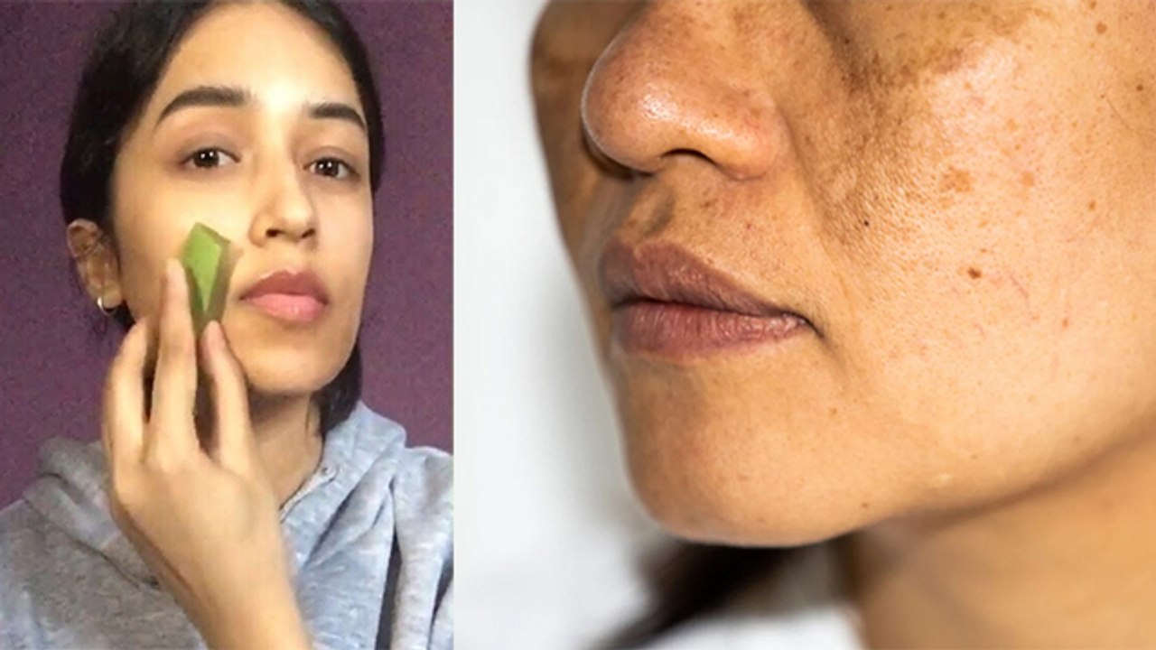 चेहरे पर एलोवेरा जेल लगाने से होते है गंभीर नुकसान।Face Par Aloe Vera
