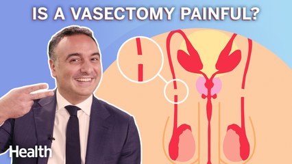 Urologist Breaks Down What Happens When You Get a Vasectomy | Ask An Expert
