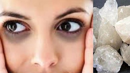 Dark Circle को मिनटों में दूर करेगा फिटकरी, बस जान लें इस्तेमाल करने का तरीका | Boldsky *Health