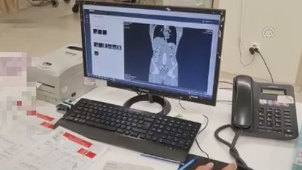 İran uyruklu 5 şüphelinin vücudundan 683 kapsül uyuşturucu çıktı