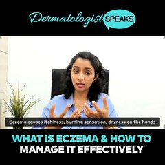 Causes, Preventions and Treatments of Eczema _ Video by Dr. Rashmi Shinde.