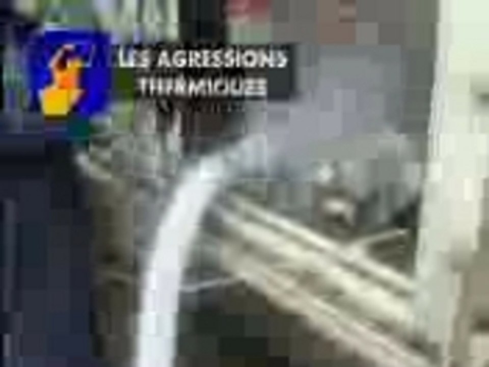 La protection des yeux