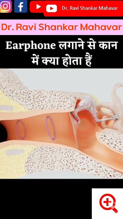 एयर फोन लगाने से क्या होता है | Ear Phone Lagane Se Kya Hota h |