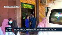 Dikira Janin, Tiga Bungkusan Berisi Darah Hasil Bekam